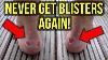 The Secret To Never Getting Blisters From Your Football Boots